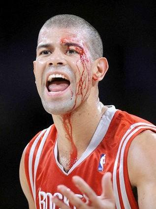 nba血腥受伤瞬间 NBA惊悚受伤瞬间盘点(3)