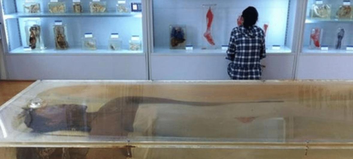 中国第一女巨人：身高2米48，比姚明还高22厘米，遗体至今没火化(6)
